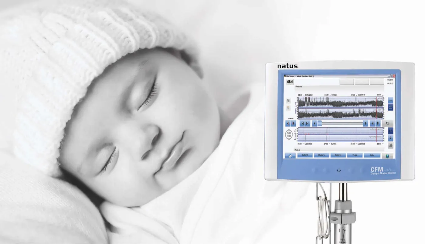 Account manager NICU